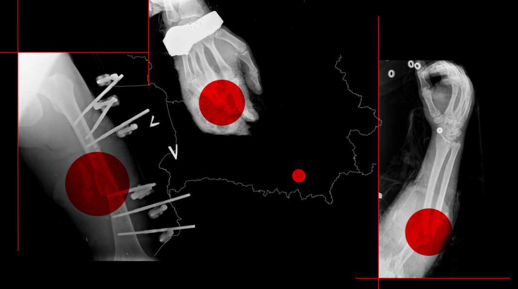 How Belarusian hospitals concealed Russia’s military casualties in the Ukraine war