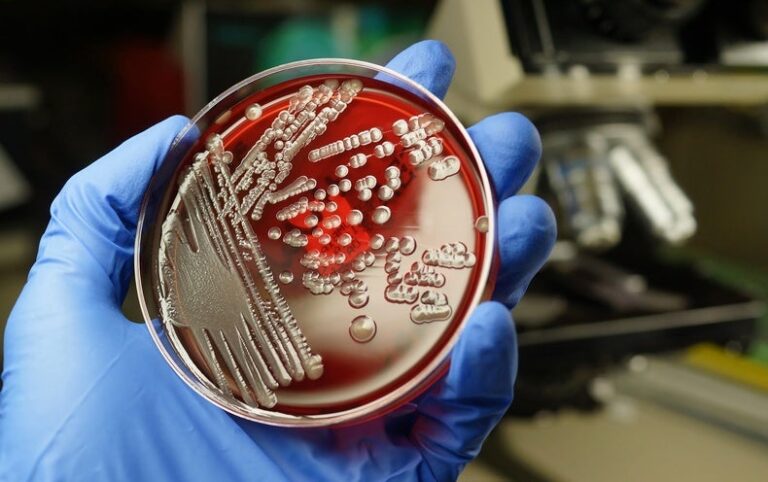 Antibiotic-Resistant UTIs Are Common, and Other Infections May Soon Be Resistant, Too