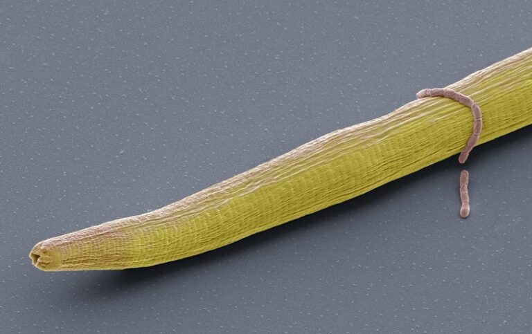 Worm Brains, Decoded like Never Before, Could Shed Light on Our Own Mind