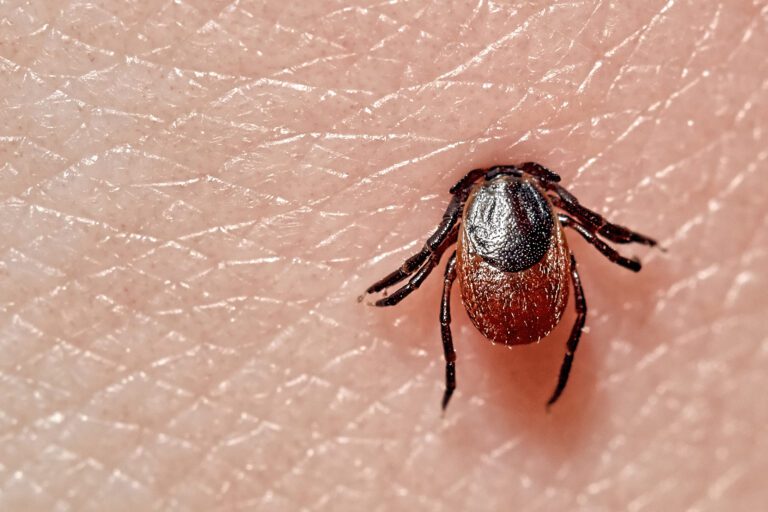 What Is Lyme Disease, and Why Are Cases on the Rise?