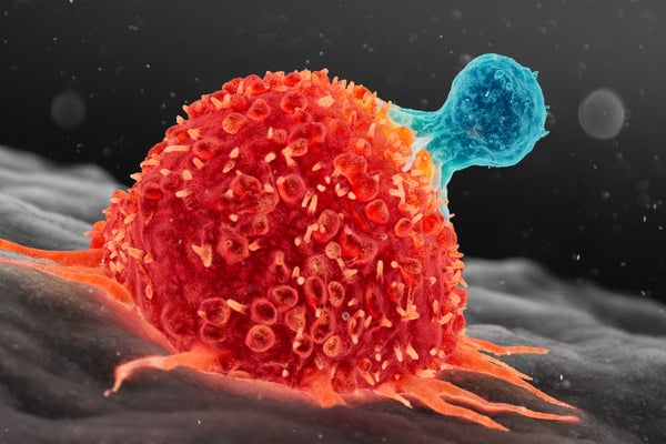 Scientists Found a Way to Supercharge Cancer-Fighting Cells